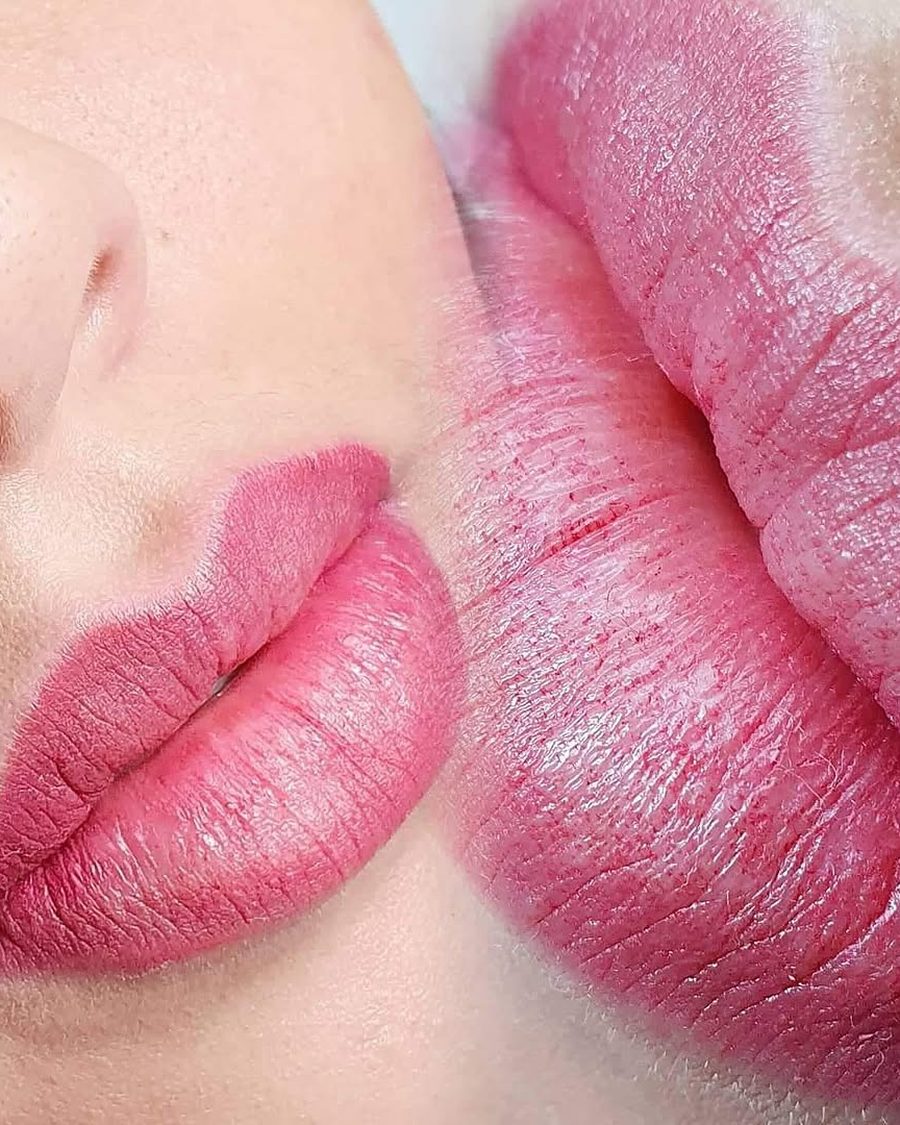Micro Labial