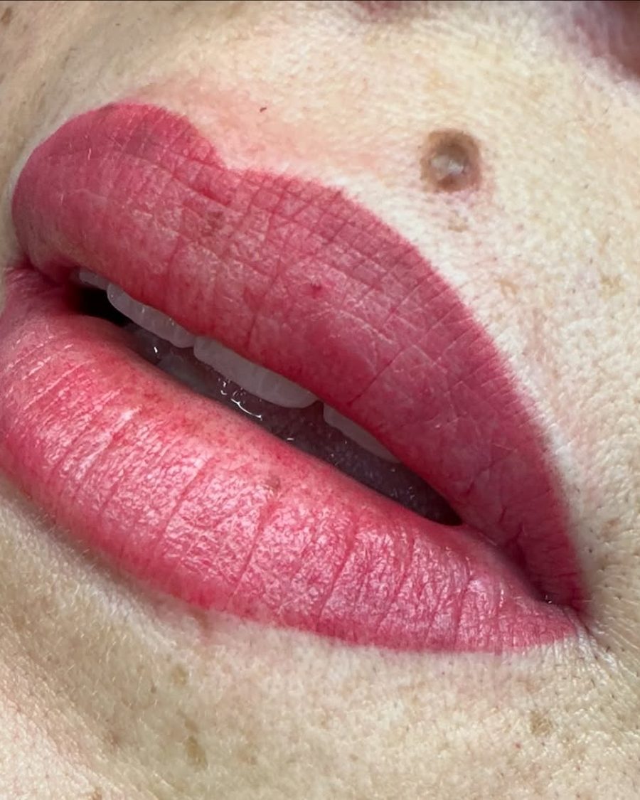 Hidragloss